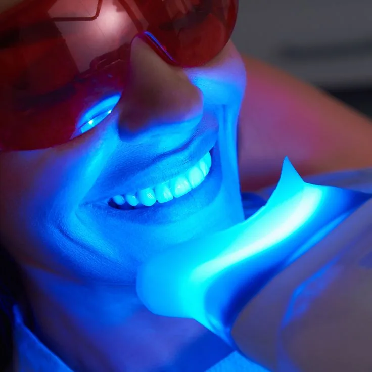 Prestation de beauté du sourire enseignée chez Lumea