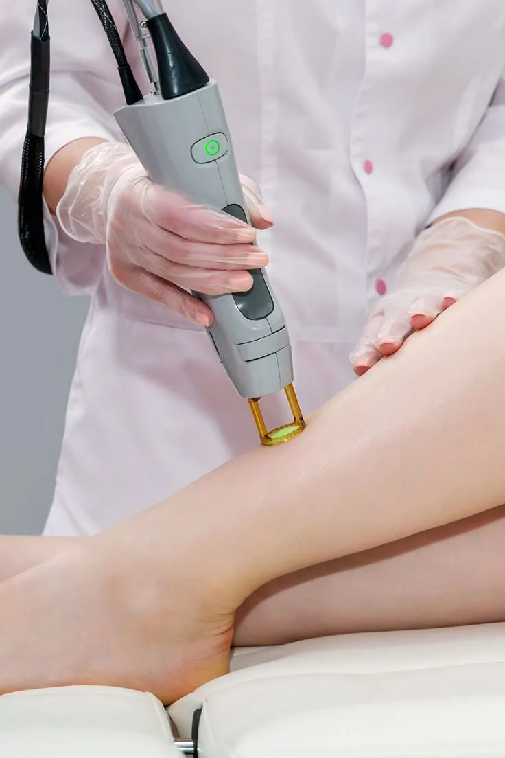 Formation Épilation Laser Diode — La pratique accompagnée sur modèle Étape de protocole enseignée pendant la formation Laser diode