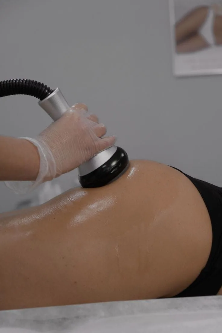 Formation Lipocavitation • Radiofréquence • Lipolaser — Le poste et le matériel Démonstration pratique de la formation Lipocavitation, RF & Lipolaser